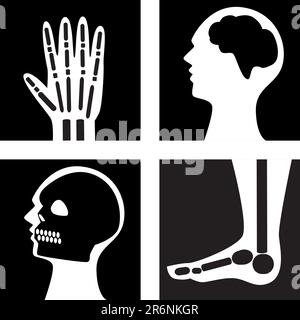 Set mit 4 verschiedenen Röntgenstrahlen des Körpers. Stock Vektor