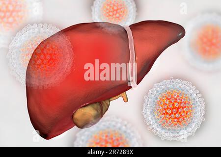 Leber mit Hepatitis und Nahaufnahme Blick auf Hepatitis C-Viren, Abbildung. Stockfoto