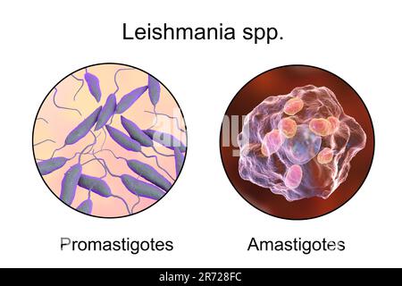 Promastigoten und Amastigotes amastigotes von Leishmania-Parasiten in Makrophagen, Kunstwerke. Leishmania sp. Verursacht Leishmaniose, eine tropische Krankheit Stockfoto