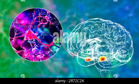 Amygdala im Gehirn und Nahaufnahme von Amygdala-Neuronen, Computerdarstellung. Zwei mandelförmige Kerne in Temporallappen, Teil o Stockfoto