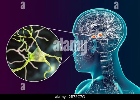 Amygdala im Gehirn und Nahaufnahme von Amygdala-Neuronen, Computerdarstellung. Zwei mandelförmige Kerne in Temporallappen, Teil o Stockfoto