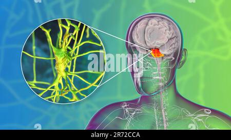 Menschliches Gehirn mit hervorgehobenen pons und Neuronen, Illustration. Menschliches Gehirn mit hervorgehobener pons Varolii und Nahaufnahme von pyramidalen Neuronen (Nerv c Stockfoto