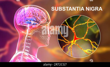 Substantia nigra. Computerdarstellung einer gesunden Substantia nigra in einem menschlichen Gehirn und Nahaufnahme dopaminerger Neuronen in den s Stockfoto