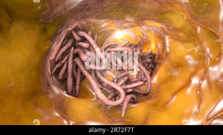 Rundwürmer im menschlichen Darm, Computerkunstwerke. Rundwürmer oder Nematoden umfassen zahlreiche frei lebende und pathogene Arten. Nematoden, die gewöhnlich sind Stockfoto