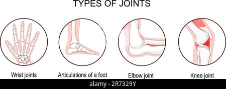 Arten von Gelenken. Biomechanische und anatomische Klassifikation. Setzen Sie Symbole mit menschlichen Ellbogen-, Knie-, Handgelenk- und Fußgelenken. Bones und j Stock Vektor