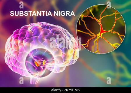 Substantia nigra. Computer zeigt eine gesunde substantia Nigra aus einem menschlichen Gehirn und eine Nahaufnahme von dopaminergen Neuronen in der gefunden Stockfoto