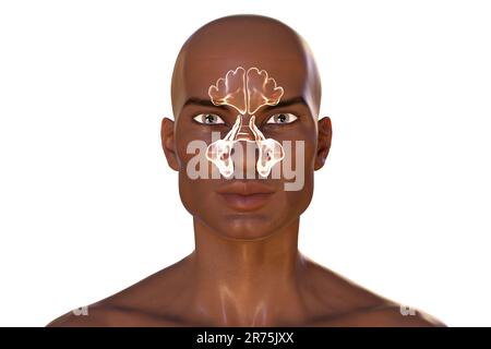 Menschliche Nebenhöhlen, Computerdarstellung. Die Nebenhöhlen sind membranausgekleidete, luftgefüllte Räume in den Gesichtsknochen. Die Stirnhöhlen befinden sich über dem Auge Stockfoto