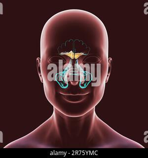 Sinusitis, Computerdarstellung. Die Nasennebenhöhlen sind membrangesäumte, luftgefüllte Räume in den Knochen des Gesichts. Die Stirnhöhlen befinden sich über den Augen. B Stockfoto