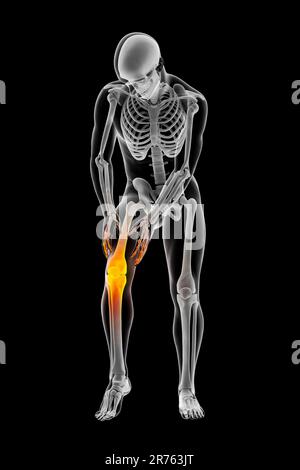 Schmerzen im menschlichen Knie, Computer Bild. Stockfoto