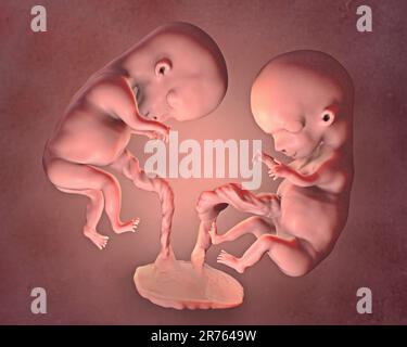 Mehrlingsschwangerschaft, Illustration. Eineiige Zwillinge im Uterus mit derselben Plazenta. Frühe fetale Periode, Woche 8 bis Woche 16. Stockfoto