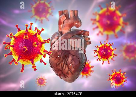 COVID-19-Viren am Herzen, konzeptionelle 3D-Illustration. Entzündungen des Herzens und anderer Organe können eine Komplikation von Covid-19, A bzw. Stockfoto