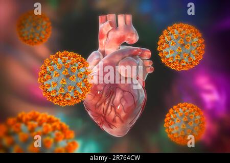 COVID-19-Viren am Herzen, konzeptionelle 3D-Illustration. Entzündungen des Herzens und anderer Organe können eine Komplikation von Covid-19, A bzw. Stockfoto