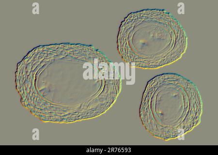 Unbefruchtete Eier von Ascaris lumbricoides, Illustration. Die Eier haben einen dicken Schutzkoffer, diese dickgeschälten Eier können ungünstige Cond überleben Stockfoto