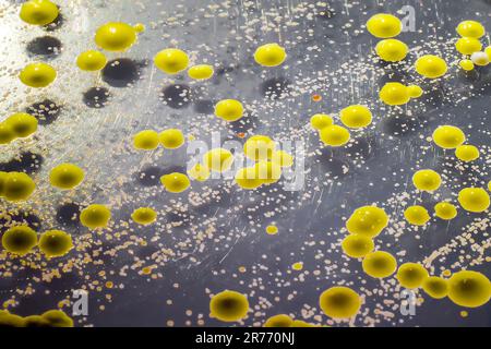 Bakterien aus einem Hautausstrich, Kolonien von Micrococcus luteus und Staphylococcus epidermidis auf Trypton-Soja-Agar. Stockfoto