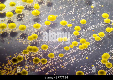 Bakterien aus einem Hautausstrich, Kolonien von Micrococcus luteus und Staphylococcus epidermidis auf Trypton-Soja-Agar. Stockfoto