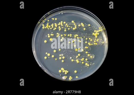 Bakterien aus Hautausstrich, Kolonien von Micrococcus luteus und Staphylococcus epidermidis auf Petrischale mit Trypton-Soja-Agar. Stockfoto