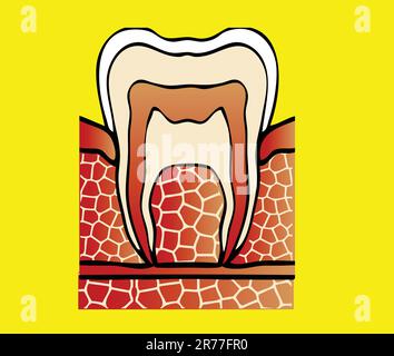 Symptome Zahnhöhlenvektordarstellung Stock Vektor