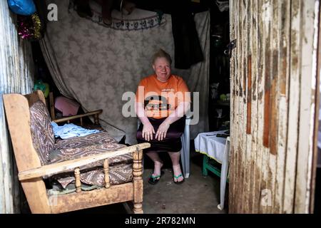 Josephine Achando, eine Albino-Mutter, die in ihrem Haus in Kibera Slum saß. Josephine Achando, ein 35-jähriger Albino, eine fünfjährige Mutter lebt mit ihren fünf Kindern, einschließlich ihres Mannes, der als Wachmann arbeitet, am Stadtrand von Langata Village in Kibera Slum. Josephine lebt seit ihrem letzten Job im Jahr 2008 arbeitslos, während sie als Putzfrau arbeitet. Als arbeitslose Mutter mit Kindern und grundlegenden Familienbedürfnissen verkauft sie geröstete Erdnüsse für das Überleben der Familie, da das Einkommen ihres Mannes nie ausreicht, um alle Bedürfnisse der Familie zu befriedigen. Sie hat aufgrund ihrer unterschiedlichen Situation keinen Job bekommen Stockfoto