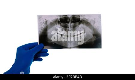 Zahnarzt Schnappschuss der Zahn des Patienten isoliert auf weißem Hintergrund analysiert der Arzt das Kieferbild Stockfoto