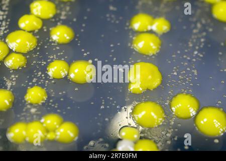 Bakterien aus Hautausstrich, Kolonien von Micrococcus luteus und Staphylococcus epidermidis auf Petrischale mit Nährmedium. Stockfoto