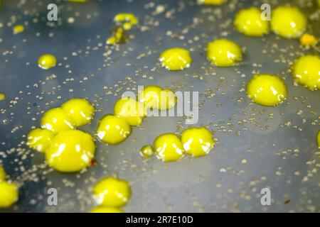 Bakterien aus Hautausstrich, Kolonien von Micrococcus luteus und Staphylococcus epidermidis auf Petrischale mit Nährmedium. Stockfoto