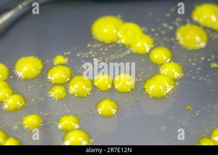 Bakterien aus Hautausstrich, Kolonien von Micrococcus luteus und Staphylococcus epidermidis auf Petrischale mit Nährmedium. Stockfoto