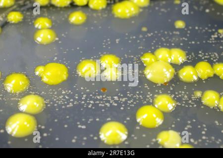 Bakterien aus Hautausstrich, Kolonien von Micrococcus luteus und Staphylococcus epidermidis auf Petrischale mit Nährmedium. Stockfoto