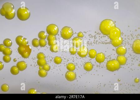 Bakterien aus Hautausstrich, Kolonien von Micrococcus luteus und Staphylococcus epidermidis auf Petrischale mit Nährmedium. Stockfoto