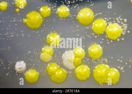 Bakterien aus Hautausstrich, Kolonien von Micrococcus luteus und Staphylococcus epidermidis auf Petrischale mit Nährmedium. Stockfoto