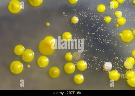 Bakterien aus Hautausstrich, Kolonien von Micrococcus luteus und Staphylococcus epidermidis auf Petrischale mit Nährmedium. Stockfoto