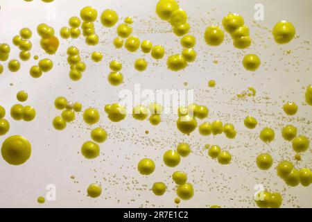 Bakterien aus Hautausstrich, Kolonien von Micrococcus luteus und Staphylococcus epidermidis auf Petrischale mit Nährmedium. Stockfoto