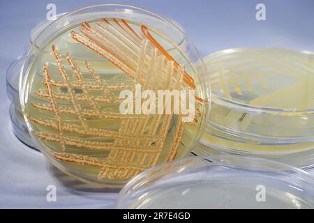 Mischkultur von Bakterien verschiedener Farben, die auf der Petrischale mit Nährmedium gezüchtet werden, Nahaufnahme. Stockfoto