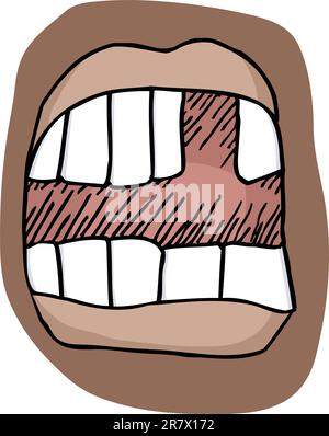 Close-up Abbildung von offenem Mund mit einem fehlenden Zahn Stock Vektor