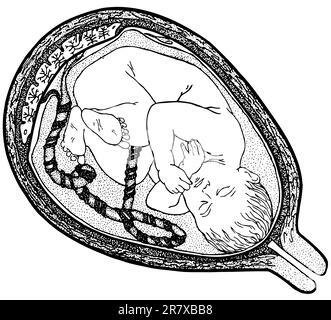 Fetus in der Gebärmutter isoliert auf weißem Hintergrund Stock Vektor