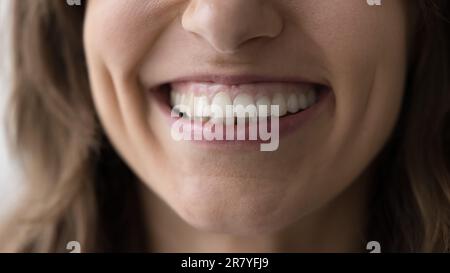 Unterer Gesichtsteil und zahniges Lächeln der jungen Frau, Nahaufnahme Stockfoto