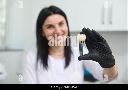 Das Handhaltemodell des Zahnarztes in Nahaufnahme zeigt den Mechanismus der zahnärztlichen Implantatinstallation. Prothese. Zahnheilkunde Stockfoto