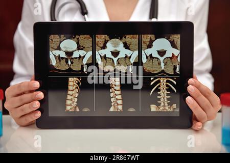 Frau Doktor zeigt Röntgenaufnahme des Patienten auf einem digitalen Tablet. Schließen Stockfoto