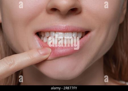 Junge Frau mit gesundem Zahnfleisch, Nahaufnahme Stockfoto