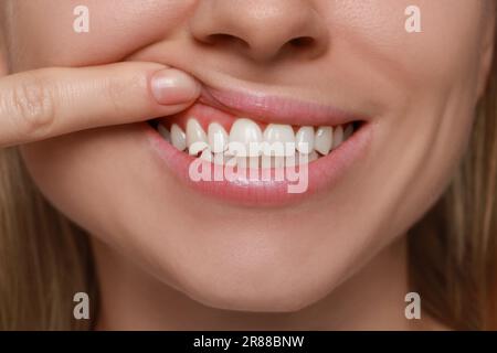 Junge Frau mit gesundem Zahnfleisch, Nahaufnahme Stockfoto