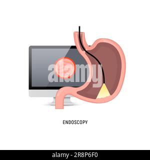 Endoskopie-Logo-Symbol. Magengastroskopie Cartoon Gastritis Medizin signalisieren Krebs egd System Icon. Stock Vektor