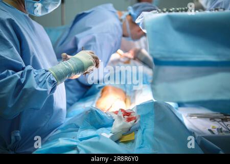 Facharzt, der einen Patienten operiert, der im Operationssaal eine Operation am offenen Herzen durchführt. Gesundheitsfürsorge und medizinisches Interventionskonzept Stockfoto