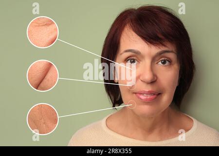 Schöne, reife Frau mit Olivenhain-Hintergrund. Vergrößerte Hautbereiche mit Falten vor Verjüngungseingriffen Stockfoto