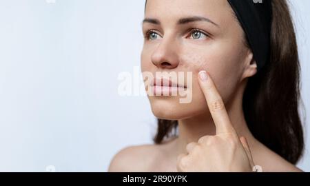 Weibliches Gesicht mit kinesiologischen Klebebändern für die Nahaufnahme des Gesichts. Schönheit, Lifting, Hautpflege. Stockfoto