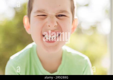 Süßer Junge mit Lückenzahn Stockfoto