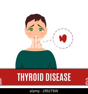 Schilddrüsenstörung, konzeptuelle Illustration Stockfoto