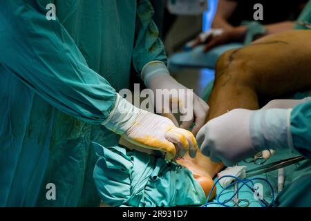 Orthopädische Chirurgen sind in der Durchführung von Beinoperationen zur Behandlung verschiedener Verletzungen geschult. Stockfoto