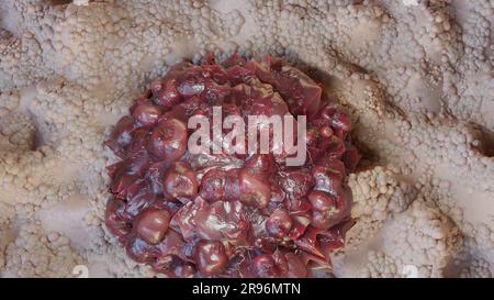 Unkontrolliertes Wachstum von Krebszellen über Gewebe, Tumorinfektionszellen und Ausbreitung, invasive Entzündung und Metastasen Krebs. Reproduzieren Stockfoto