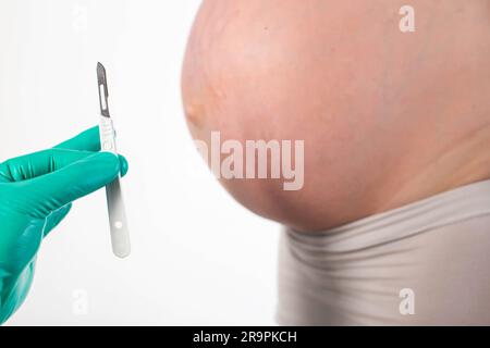 Chirurgisches Skalpell am Hintergrund des Bauches eines schwangeren Mädchens. Das Konzept einer operativen Operation zur Kaiserschnitt-Entbindung. Nahaufnahme Stockfoto