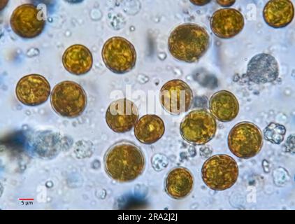 Zooxanthellae aus einer weichen Koralle (wahrscheinlich Sinularia sp.). Die einzelnen Zellen haben einen Durchmesser von 10-12 µm. Stockfoto