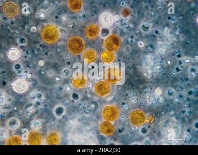 Zooxanthellae aus einer weichen Koralle (wahrscheinlich Sinularia sp.). Die einzelnen Zellen haben einen Durchmesser von 10-12 µm. Stockfoto
